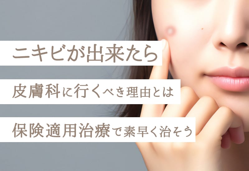 ニキビが出来たら皮膚科に行くべき理由とは・保険適用治療で素早く治そう！